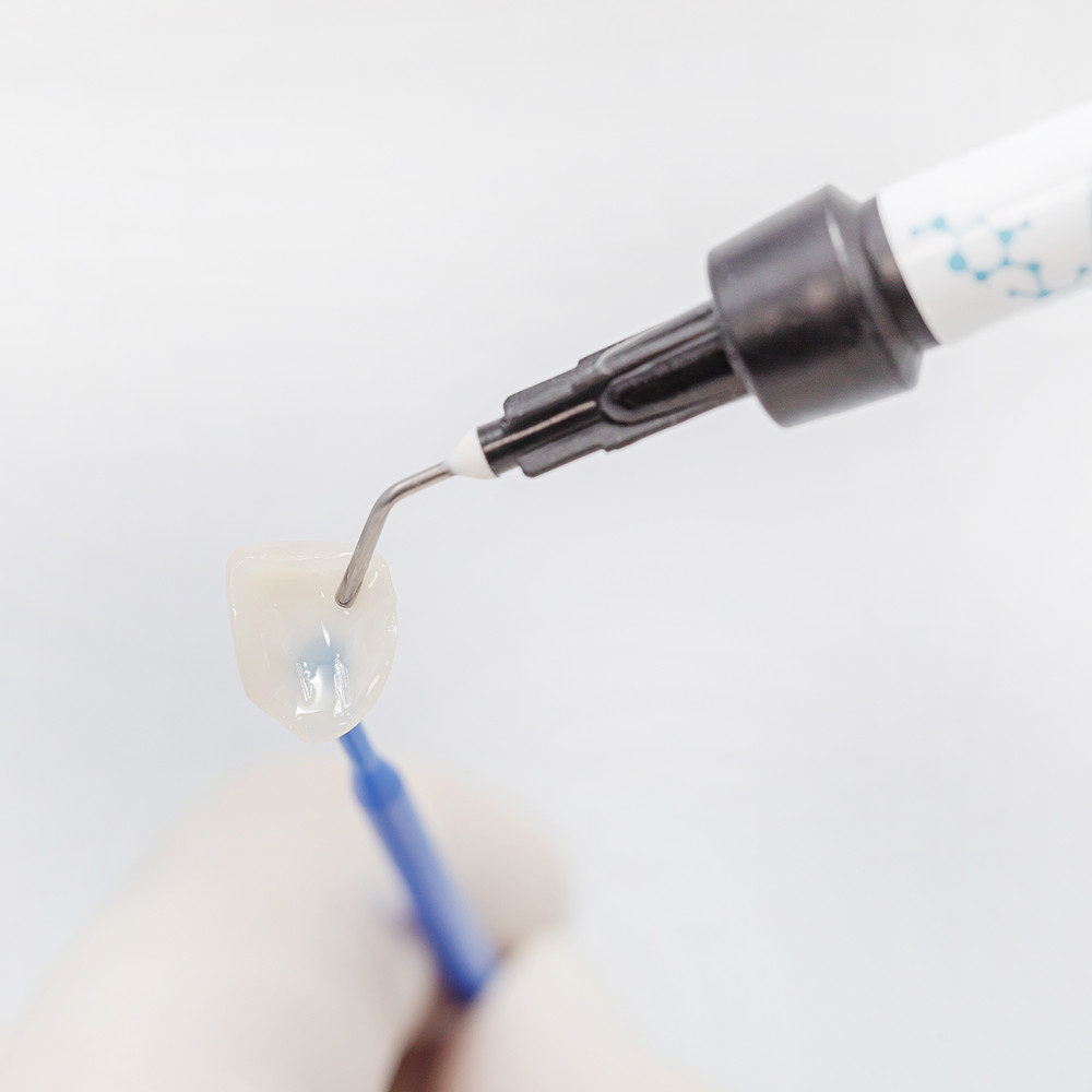 HUGE TOPCEM Veneer System- Veneer Cement Cementation Restorations KIT