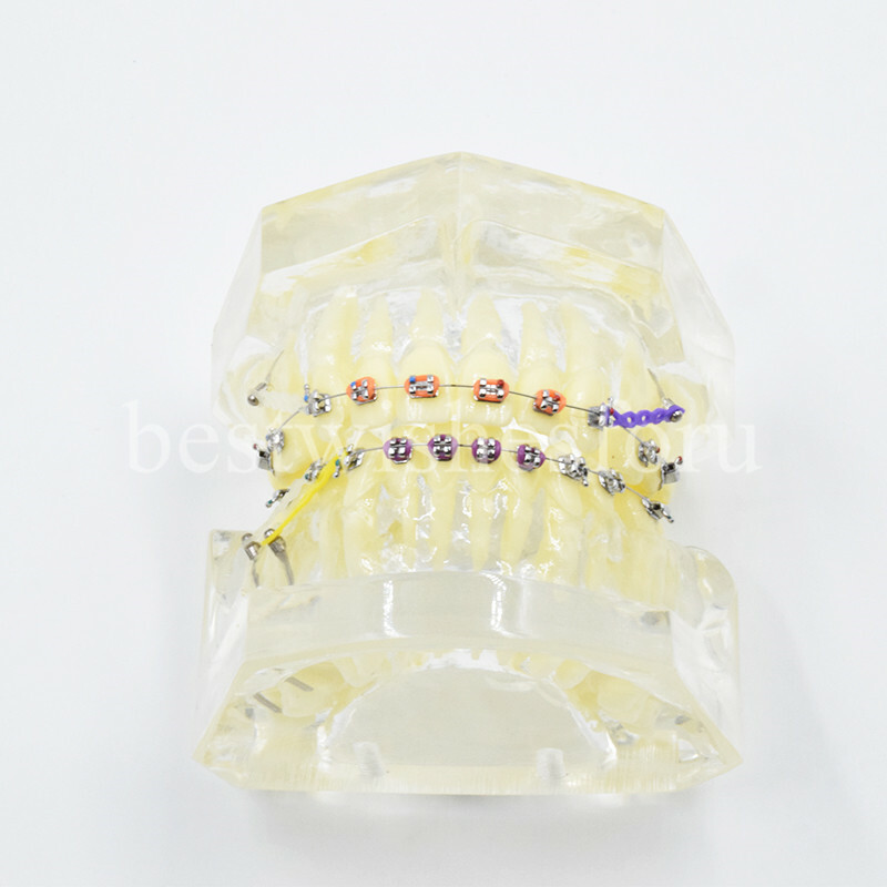 Dental Malocclusion Treatment Teeth Model Study Typodont Elastic chain 3005-2
