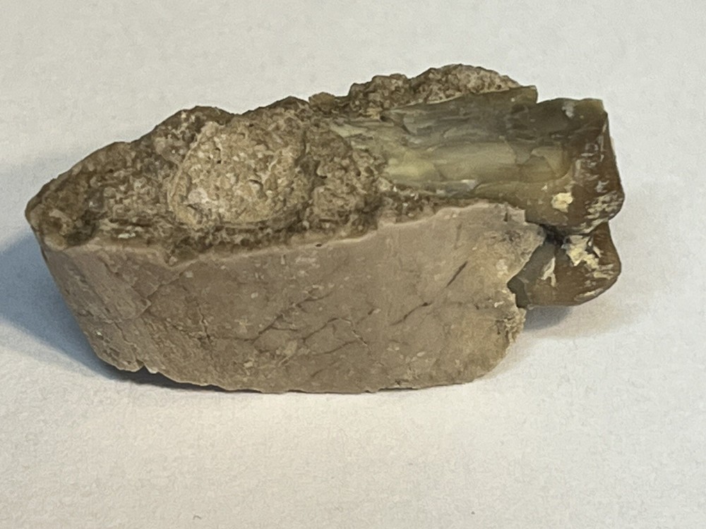 Oriodant Teeth In Jaw Bone #4