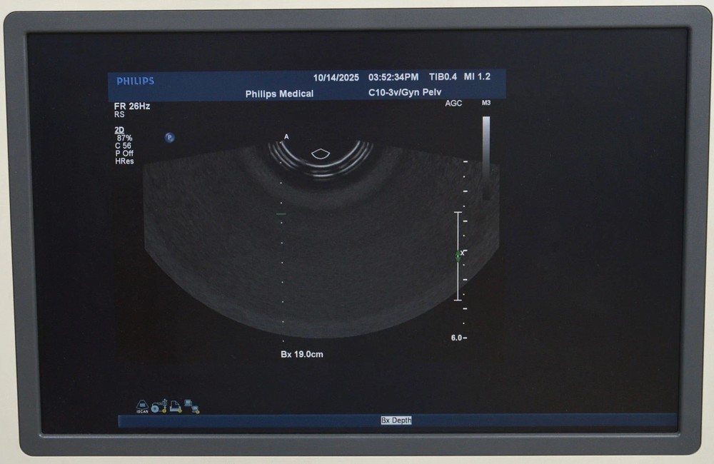 Philips iU22 System 8500-0064 W/ Philips C10-3v Broadband Curved Array