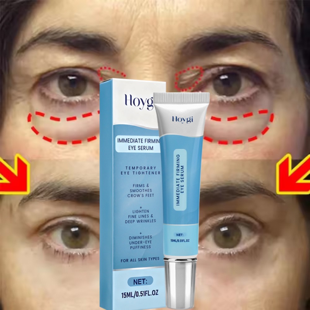 3-Under Eye Cream Remove Dark Circles Bags Face Lines Ageless Wrinkles Puffy Eye