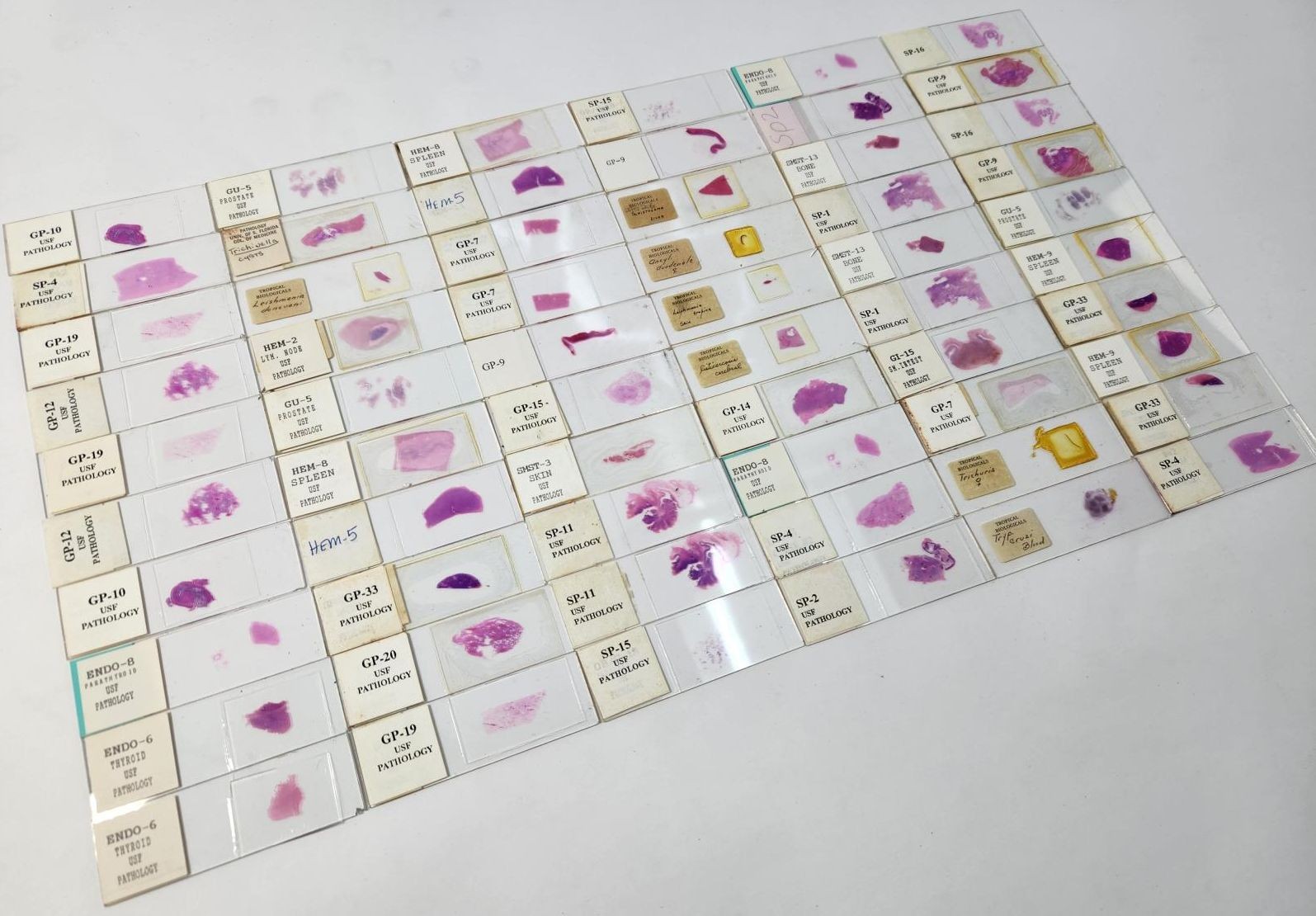Lot Of 50 Vintage University Prepared Pathology Microscope Slides - Slides Only