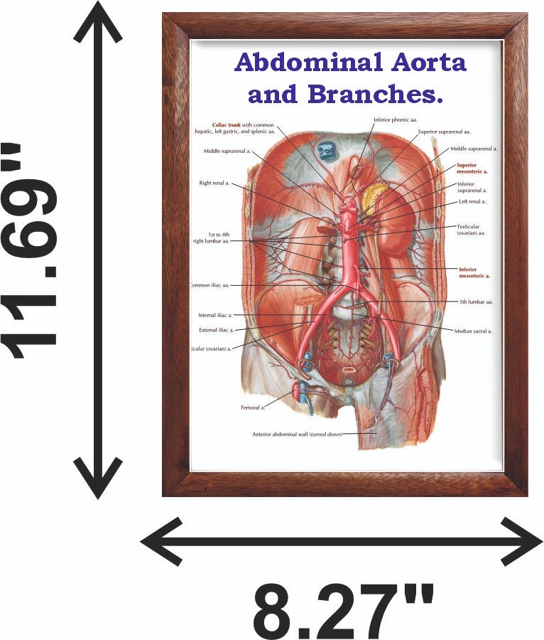 Abdominal Aorta and Branches Chart 12x18 inches