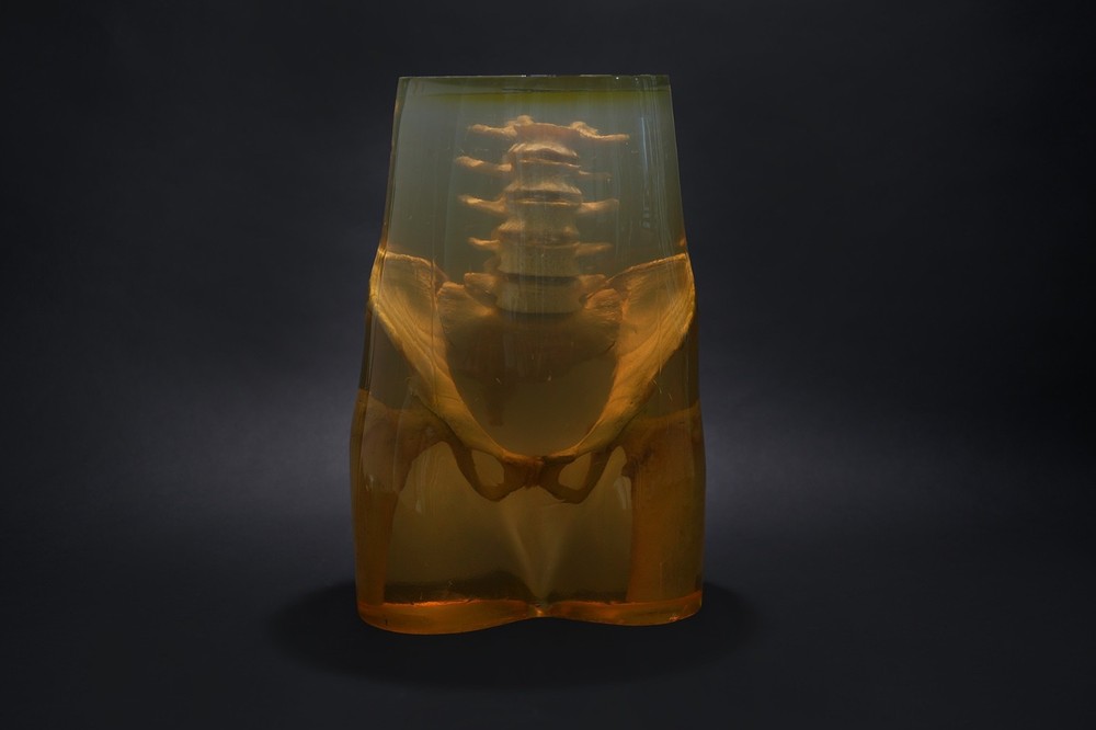3M Xray Calibration Phantom Pelvis C.1960's