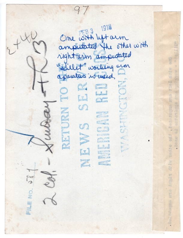 1918 Two Frenchmen With Different Arms Amputated Farming Original News Photo