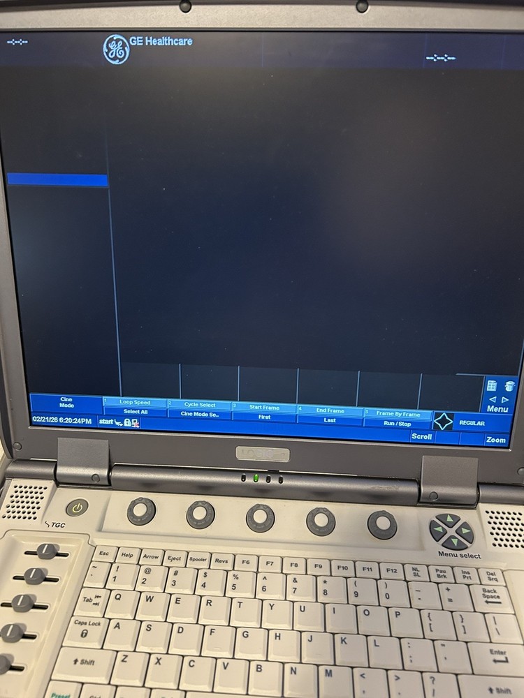 GE LOGIQ E Ultrasound System
