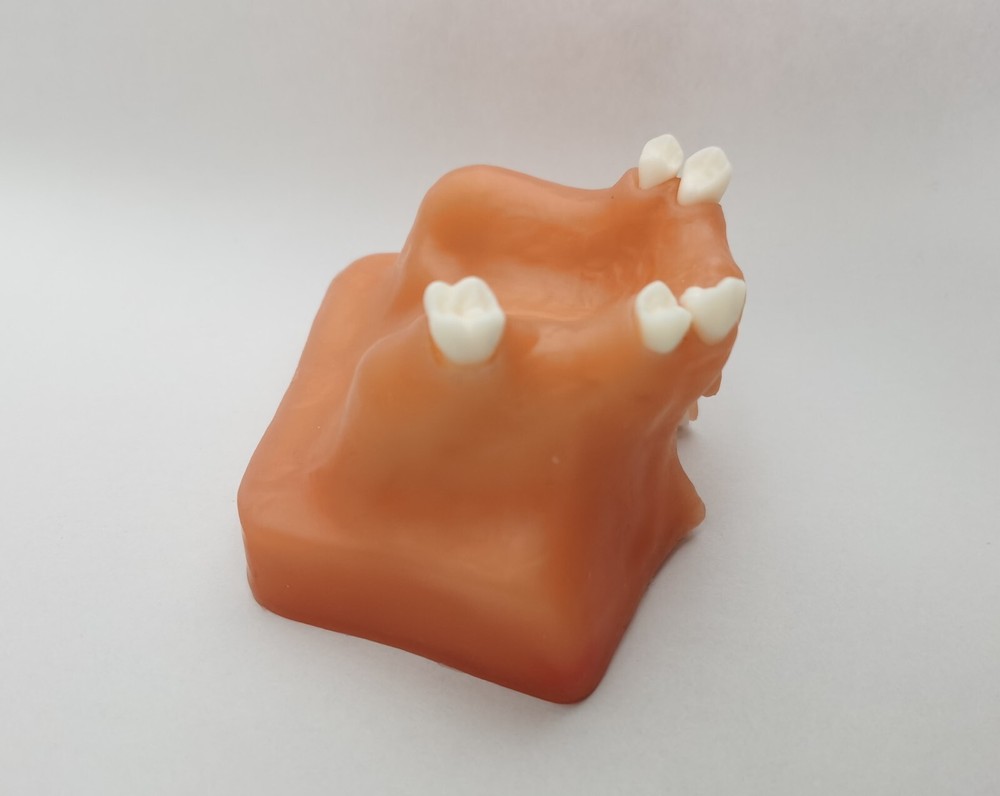 Dental Maxillary Sinus Lift Model Typodont Practice Model Show