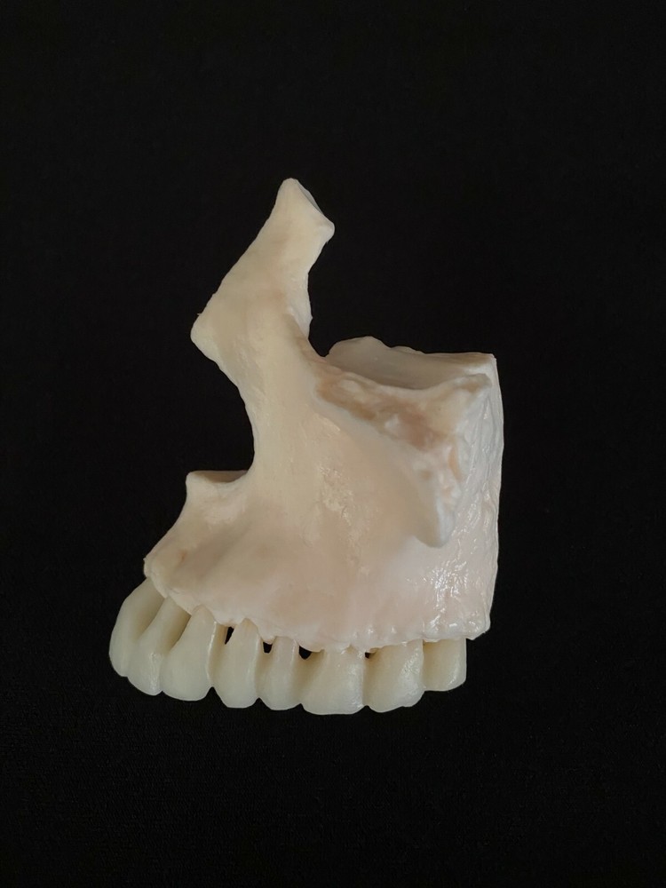 Anatomical Human Maxilla Bone with Teeth Model -   Cranial Base Skeleton Anatomy