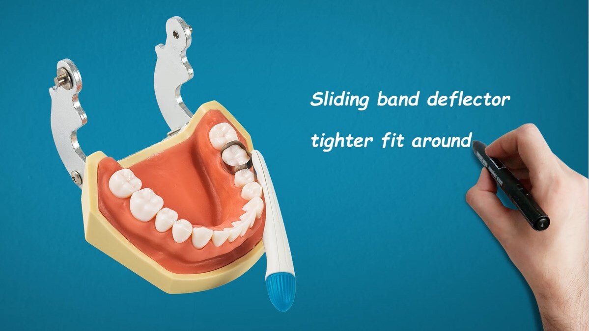 Adjust Dental Pro Matrix Bands Molar/Premolar Restoration Pre Formed 10/20/30Pcs