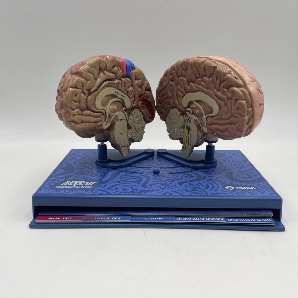 Maxalt Brain Anatomical Model Migraine Pathology Education Teaching Model
