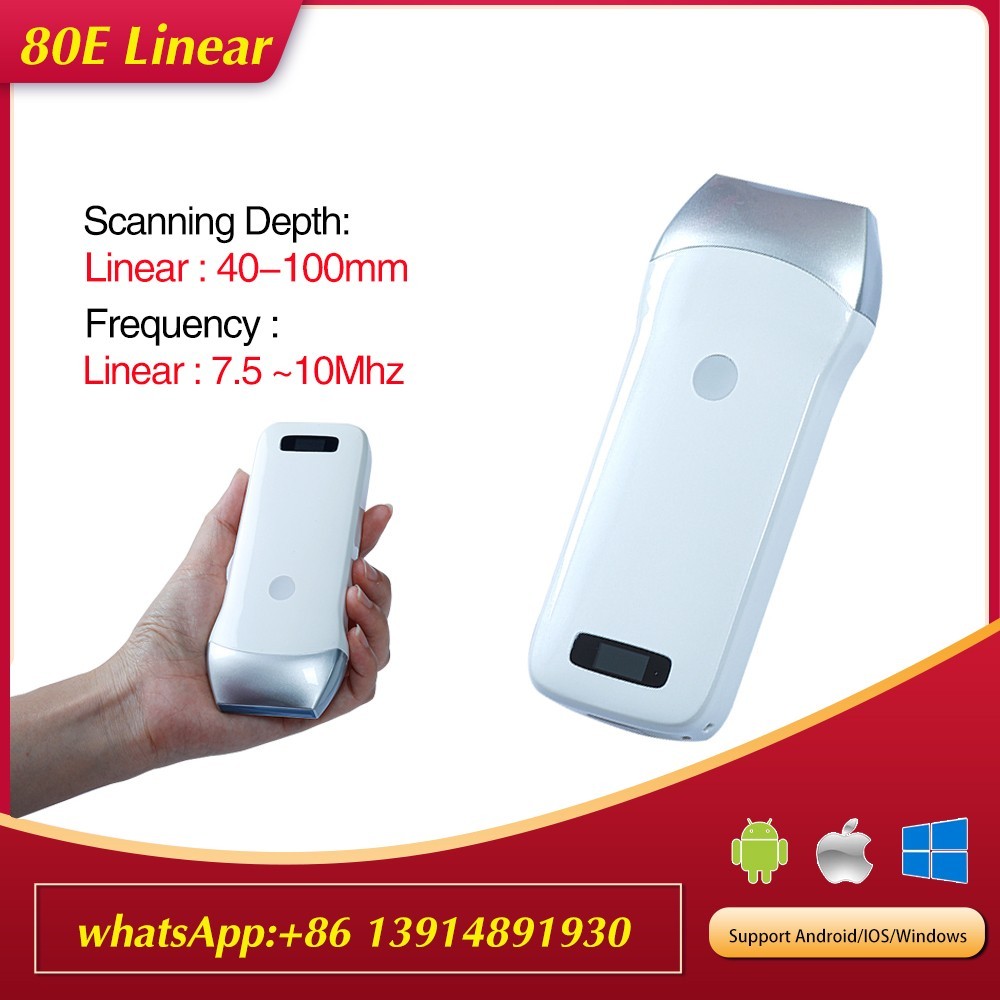 Wireless Ultrasound Probe 80Elements Scanner Machine Support iOS Android Windows