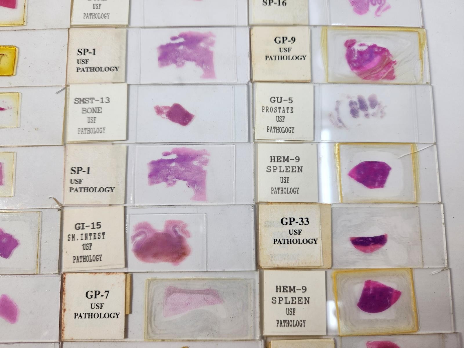 Lot Of 50 Vintage University Prepared Pathology Microscope Slides - Slides Only