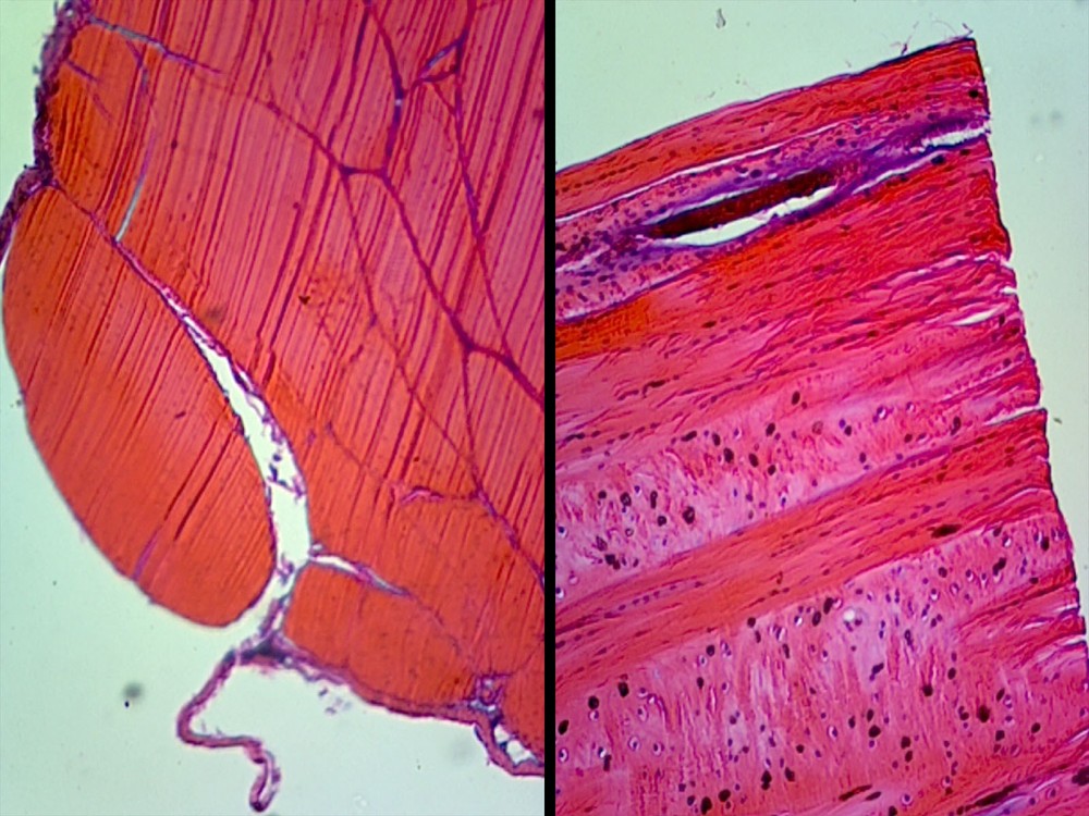 Human Tendon Composite; Cross Section and Longitudinal Section