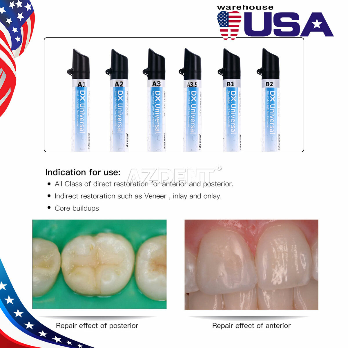 Dentex Dental Universal Composite Curing Light Resina Resin Refill A1 A2 A3 A3.5