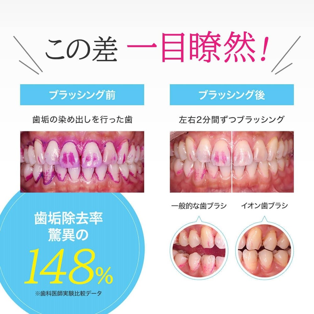 Ionic Toothbrush [Body] with V-Cut Medium Bristles Made in Japan, Interchange...