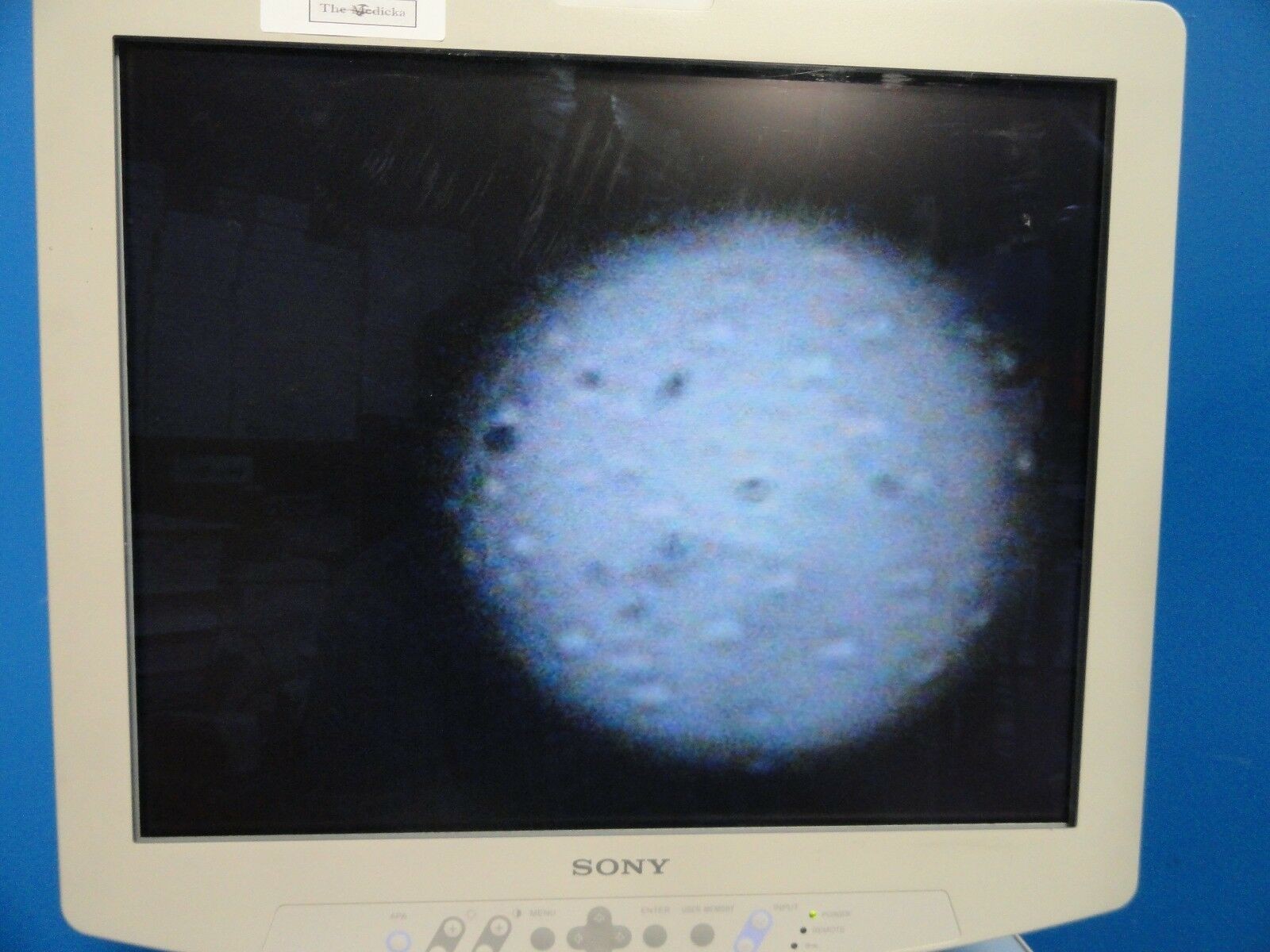 2011 Boston Scientific Spyglass Direct Visualization ~15313