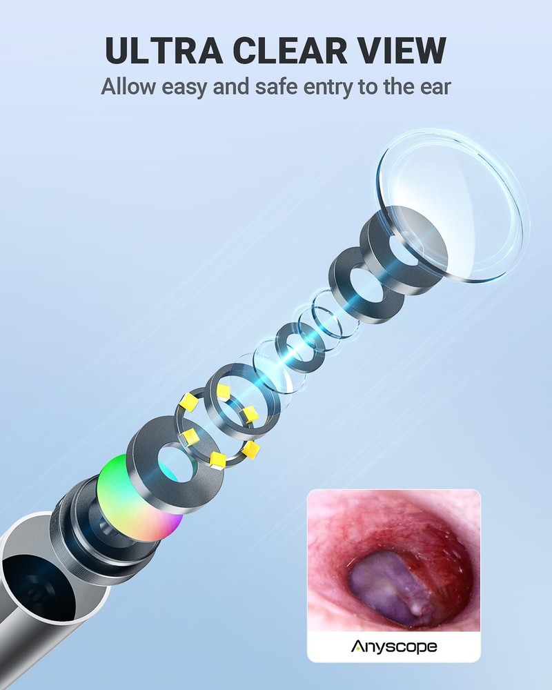 AnyScope Digital Otoscope Compatible with iPhone and Android Devices, HD Ear ...