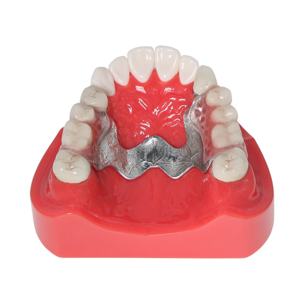 Dental Multi Typodont Teeth Model for Implant Pathological Restoration Practice