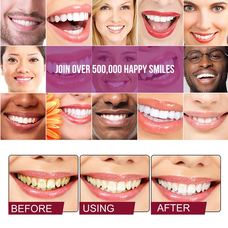 2PC Sp-6 Probiotics Whitening Toothpaste Brightening Breath Removing Toothpaste