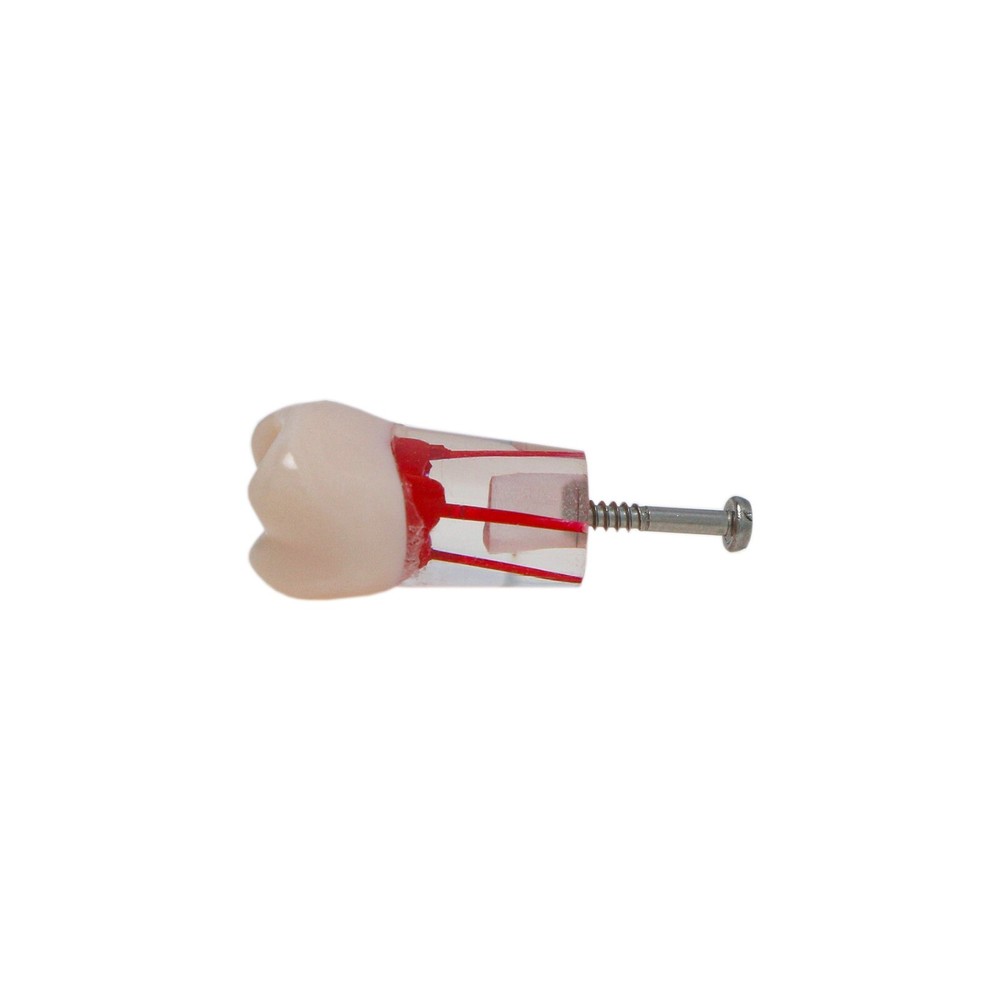 26# (UL6 First Molar) Training Models for Root Canal Procedures Dental Endo Root