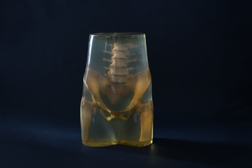 3M Xray Calibration Phantom Pelvis C.1960's