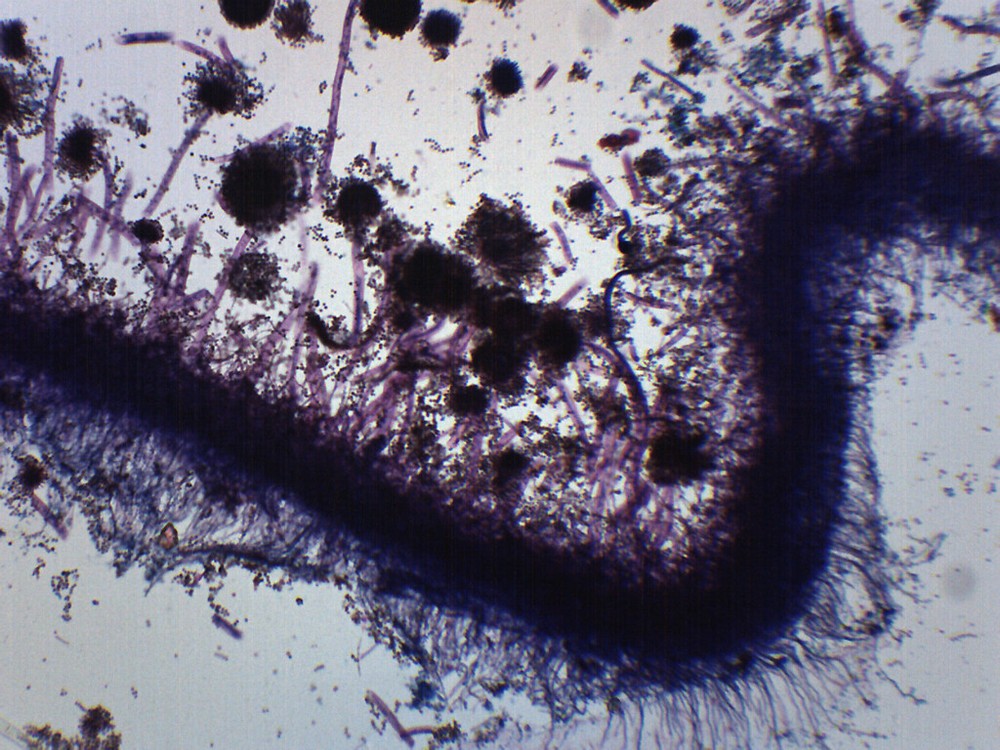Aspergillus (Brown Mold) - Prepared Microscope Slide - 75x25mm - Eisco Labs