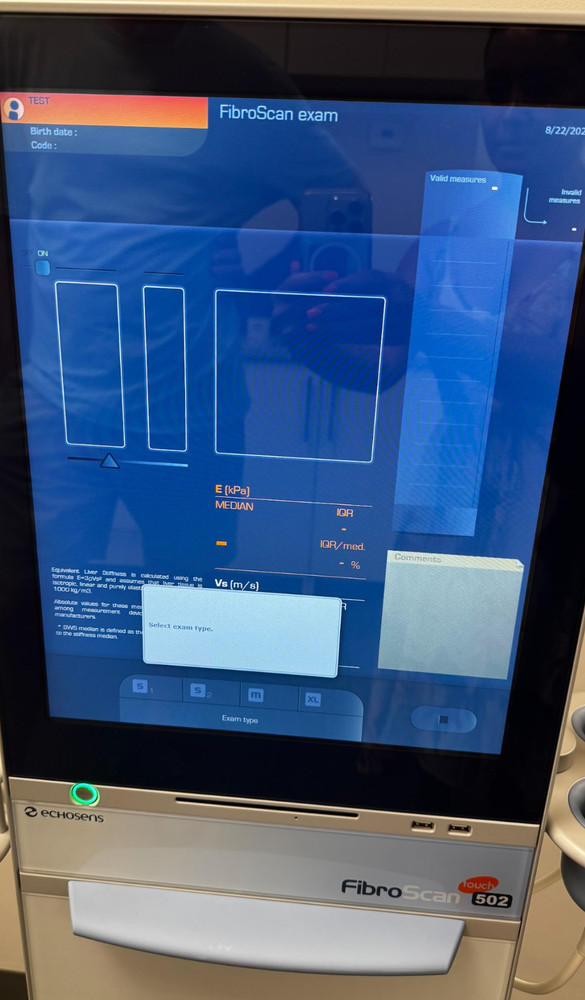 Echosens 502 Fibroscan-2015