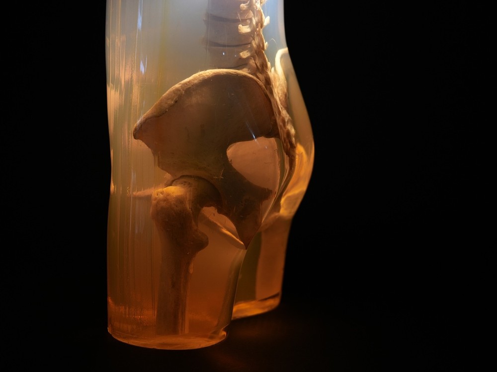 3M Xray Calibration Phantom Pelvis C.1960's