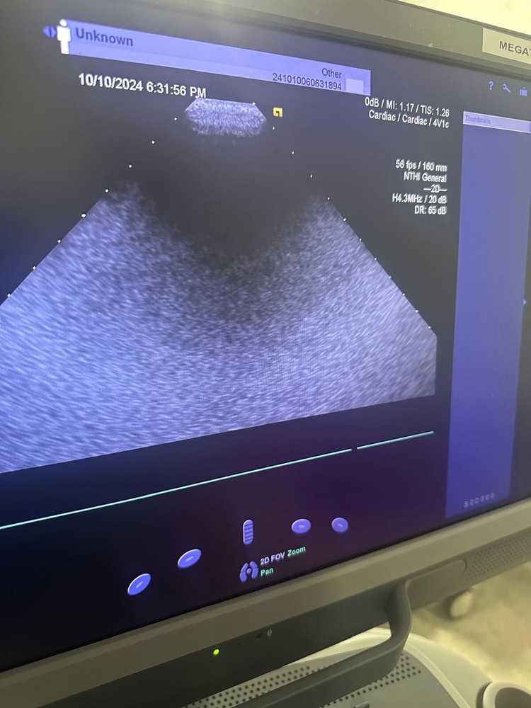 2019 Siemens Acuson S2000 with 8V3 , 4V1c, 10V4 Probes