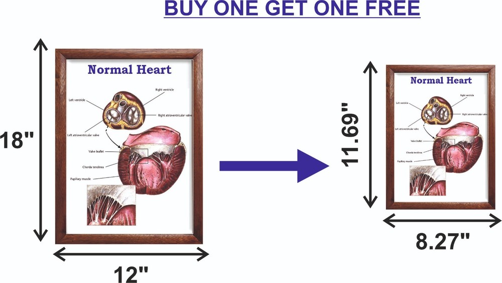 Normal Heart Chart 12x18 inches