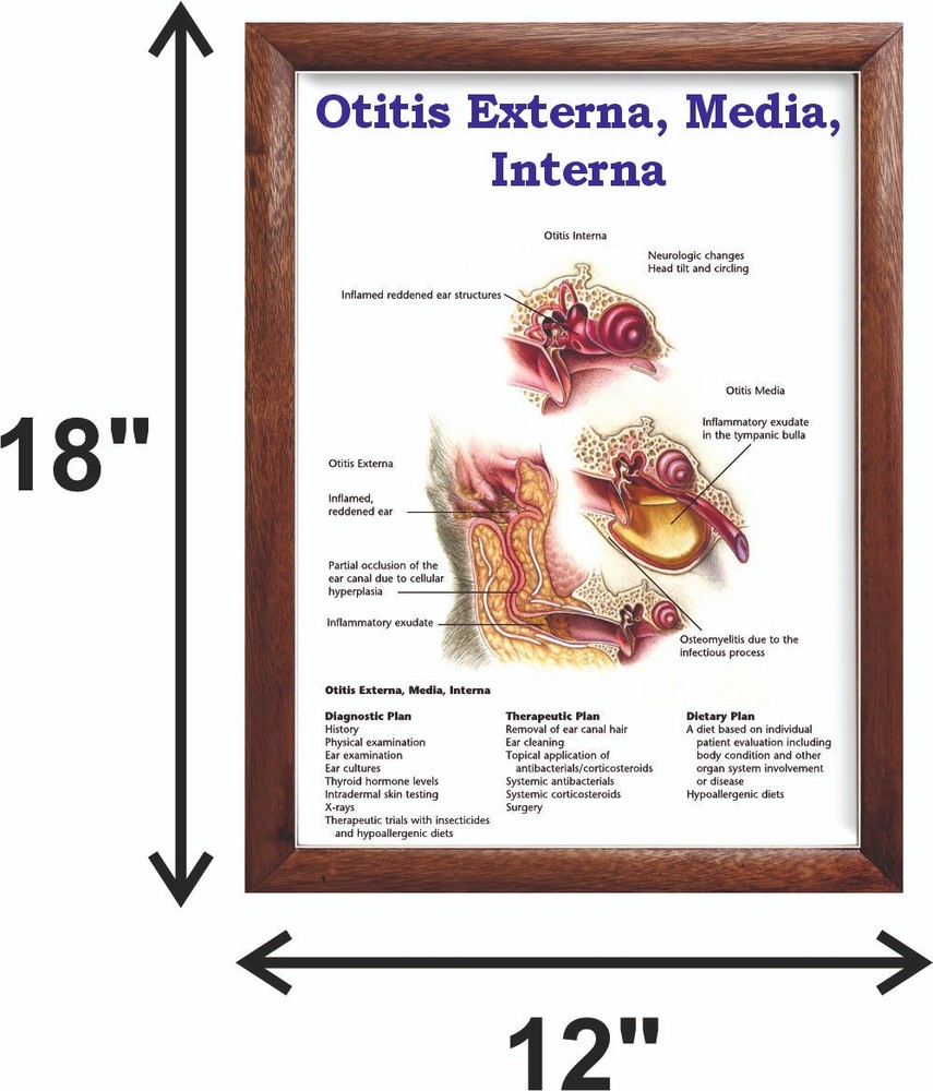 Otitis Externa, Media, Interna Chart 12x18 inches