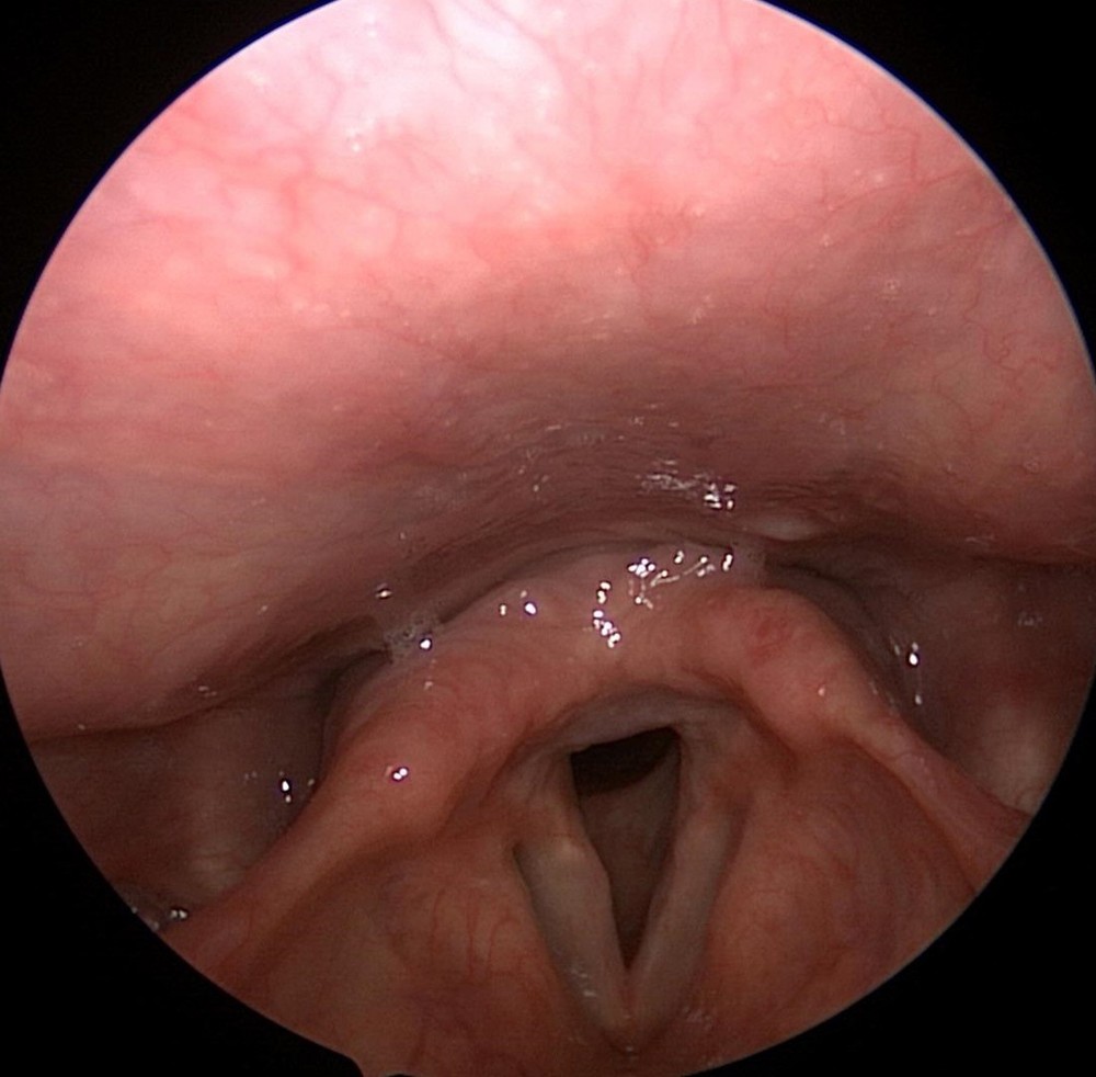 Rigid Endoscope Endoscopy ENT HD USB Camera Head+Light Source LED for Stryker