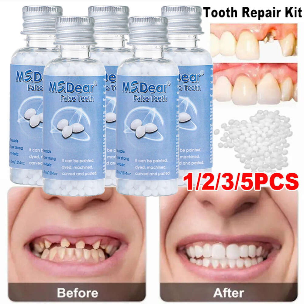Tooth Repair Kit - Temporary Teeth Replacement Kit for Missing & Broken Teeth