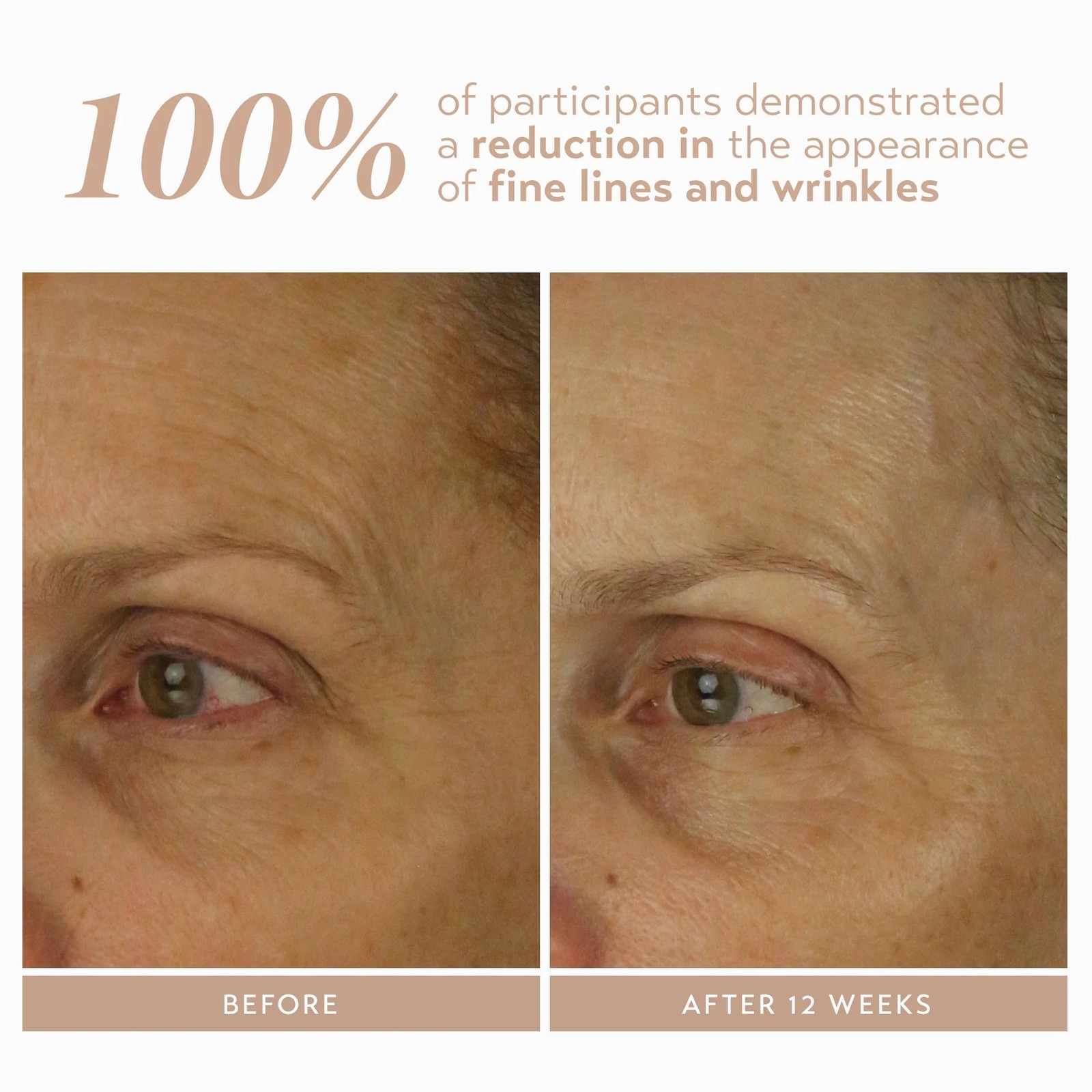 SHANI DARDEN SKIN CARE Retinol Reform with 1% Encapsulated Retinol Serum for Fac