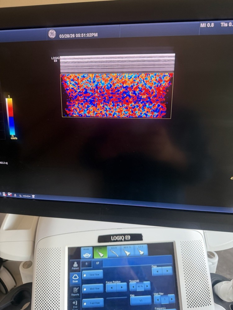 2017 GE 11 L D Probe Excellent working condition