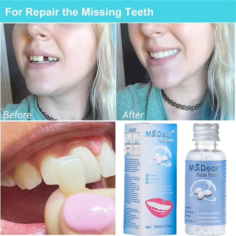 3/1x Tooth Repair Granules Temporary Reusable Moldable False Teeth Fitting Beads