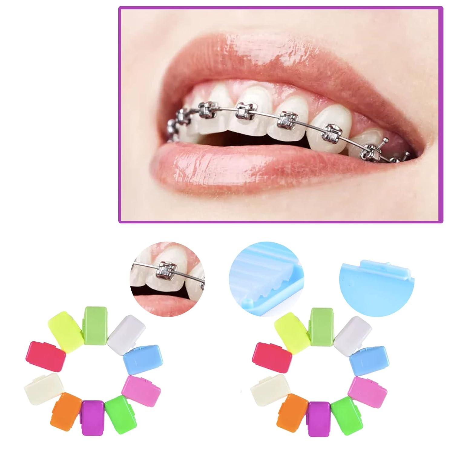 10 Scents Dental Orthodontics Ortho Wax For Braces Gum Irritation 100 Packs