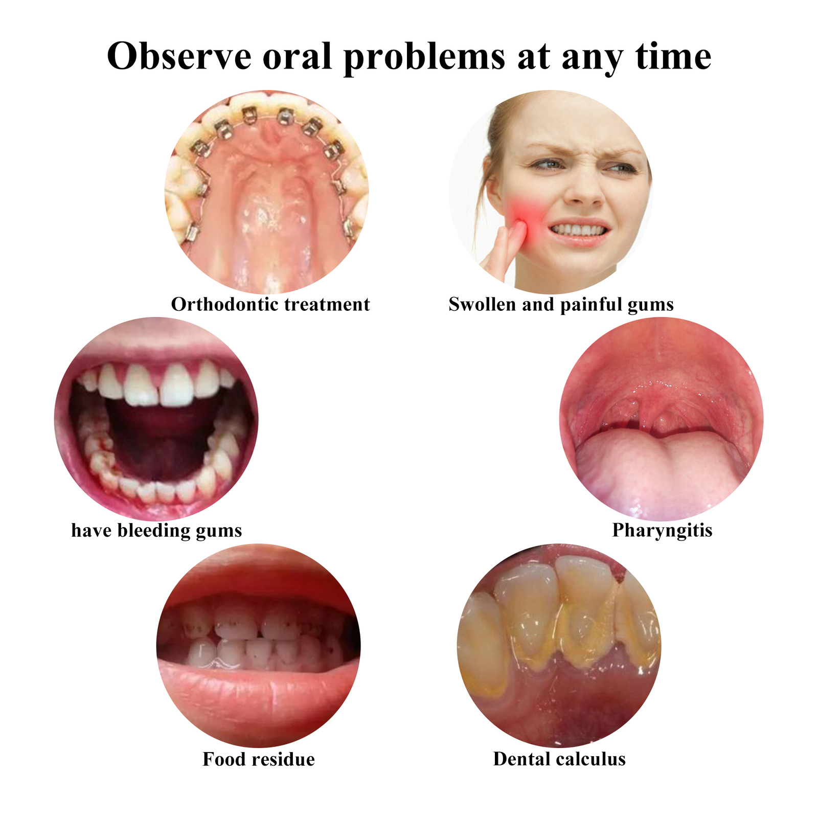 Dental 1080P Wireless Oral Camera 8 LEDs HD Digital Imaging Intraoral Endoscope