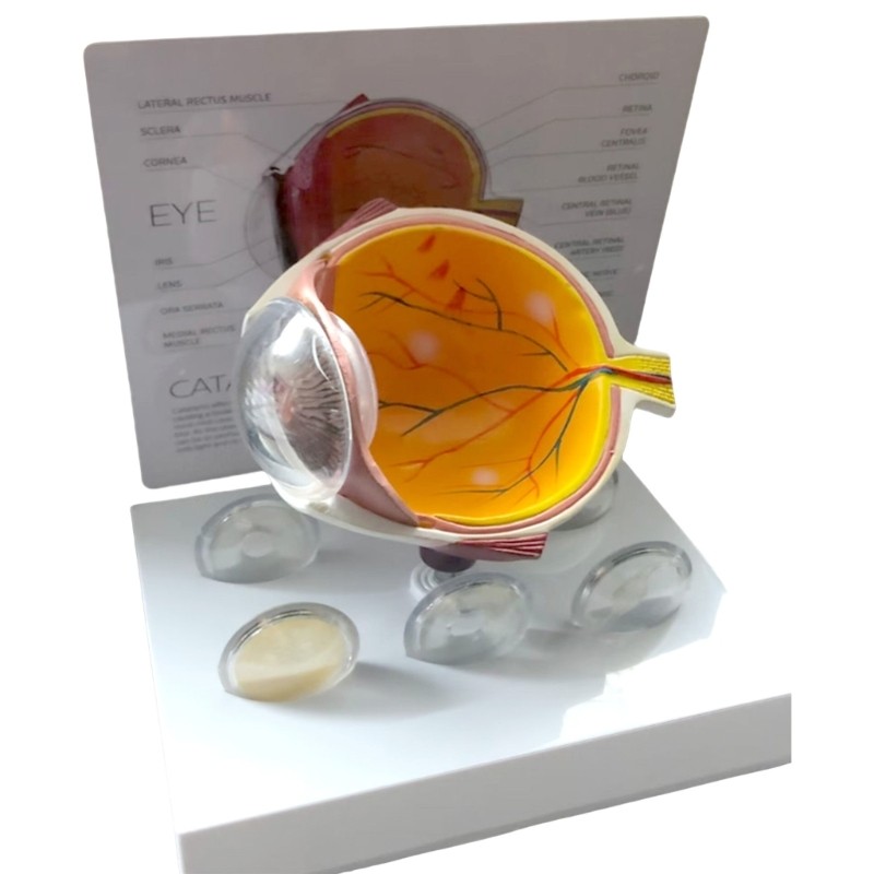 Human Anatomical Eye Model Realistic Pathological Eyeball Anatomy Model