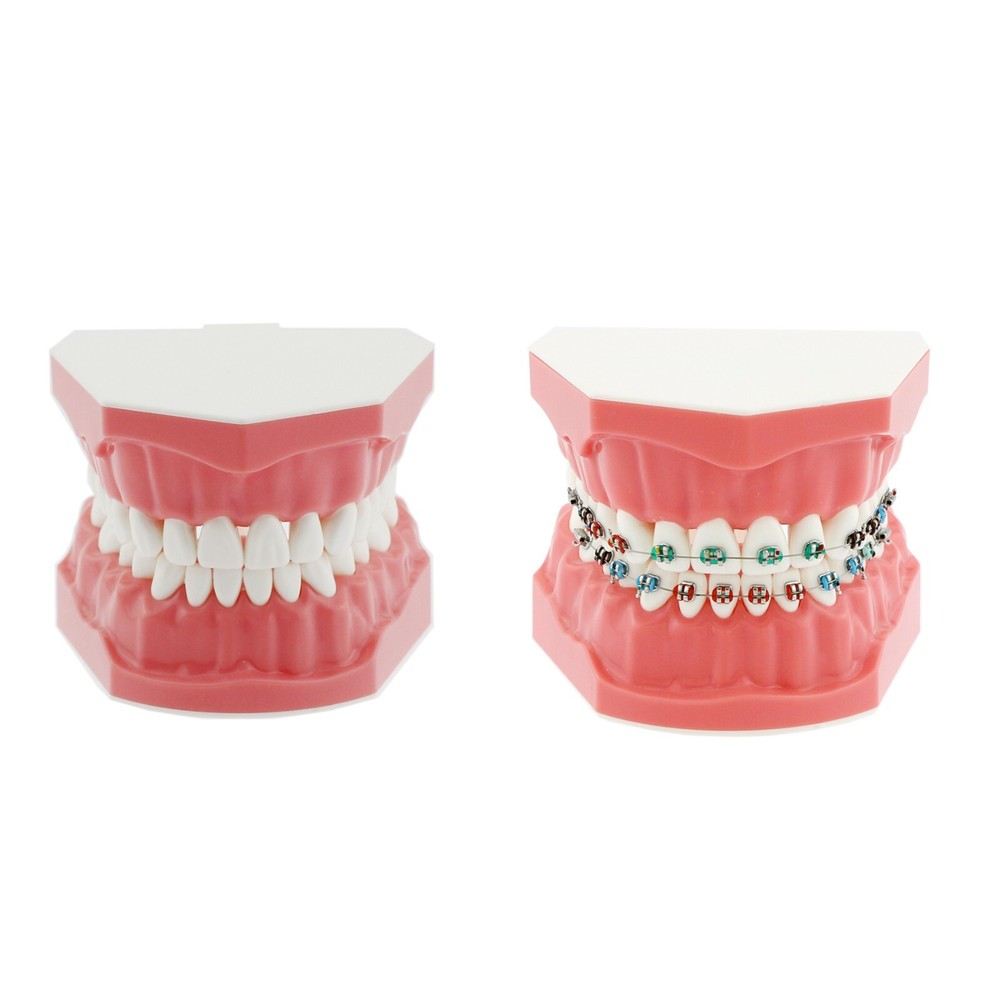 US Dental Typodont Brushing Flossing Practice Teeth Model with Metal Brackets