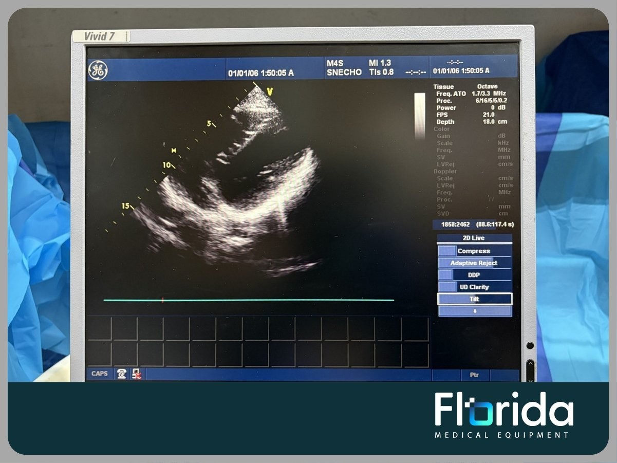 2013 GE M4S SECTOR ARRAY ULTRASOUND TRANSDUCER PROBE REF: 5129041 TESTED