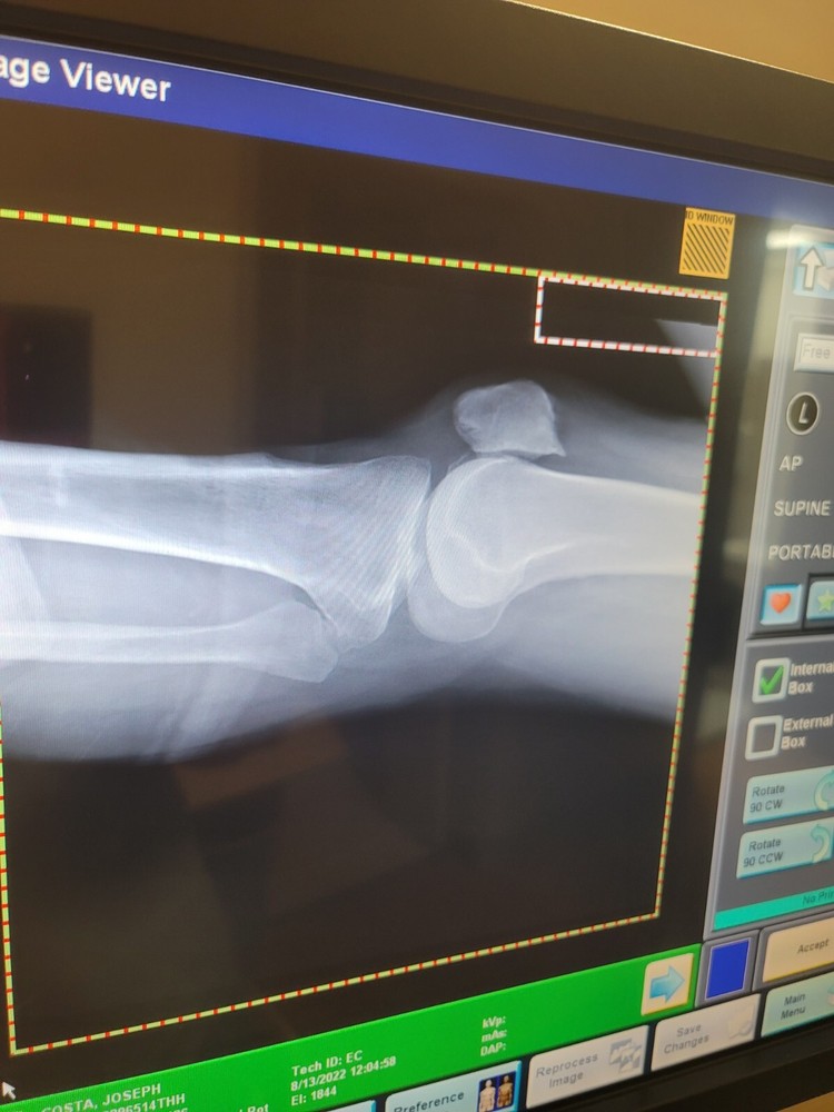 Carestream DRX-PLUS Portable DR Panel For Revolution