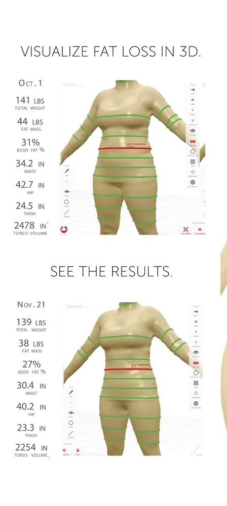 Styku 3D Body Scanner - Complete System