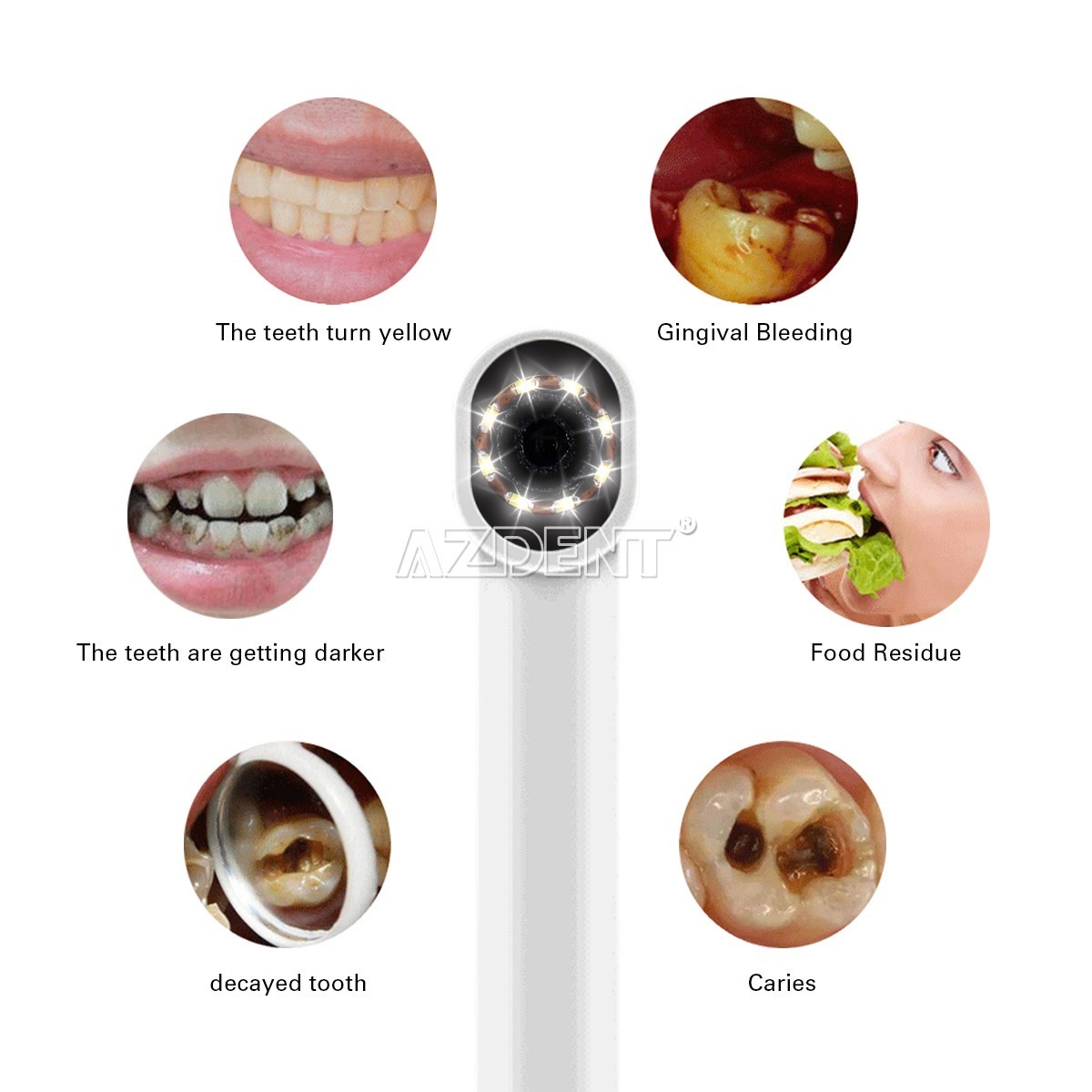 Dental Intraoral Camera USB Digital Imaging Intra Oral HD Camera 8 LED light