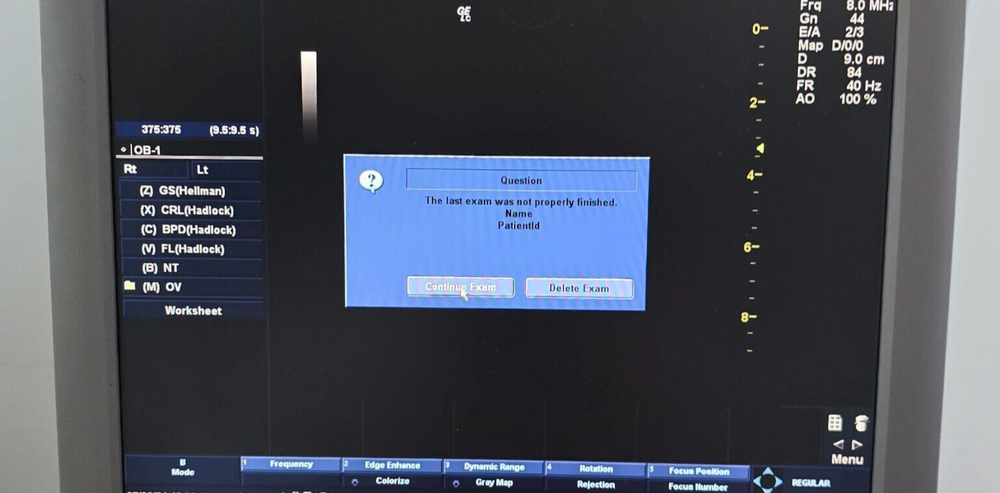 GE LOGIQ C3 Premium Ultrasound Machine without probe