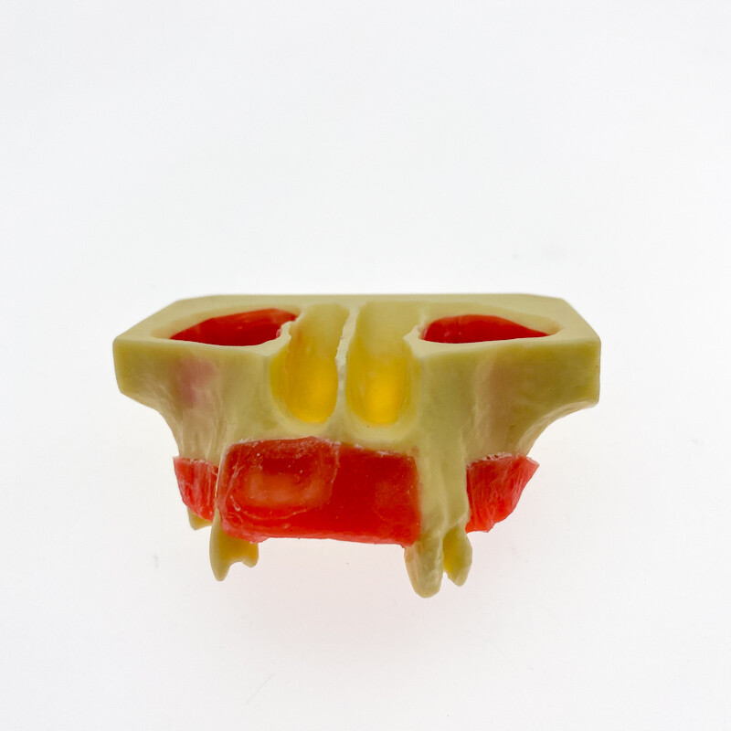 Dental Sinus Lift Practice Teeth Model Typodont Study Tooth Model M2012