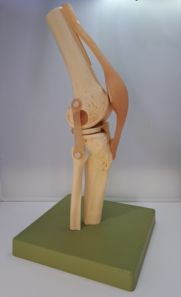 Vintage 1995 Somso Anatomical Model Functional Knee Joint Model BIN86