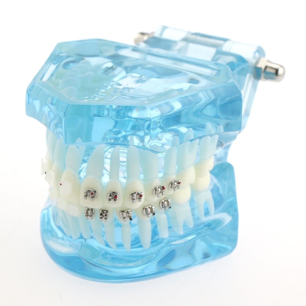 Dental Orthodontic Metal & Ceramic Bracket Brace Teeth Study Teach Model