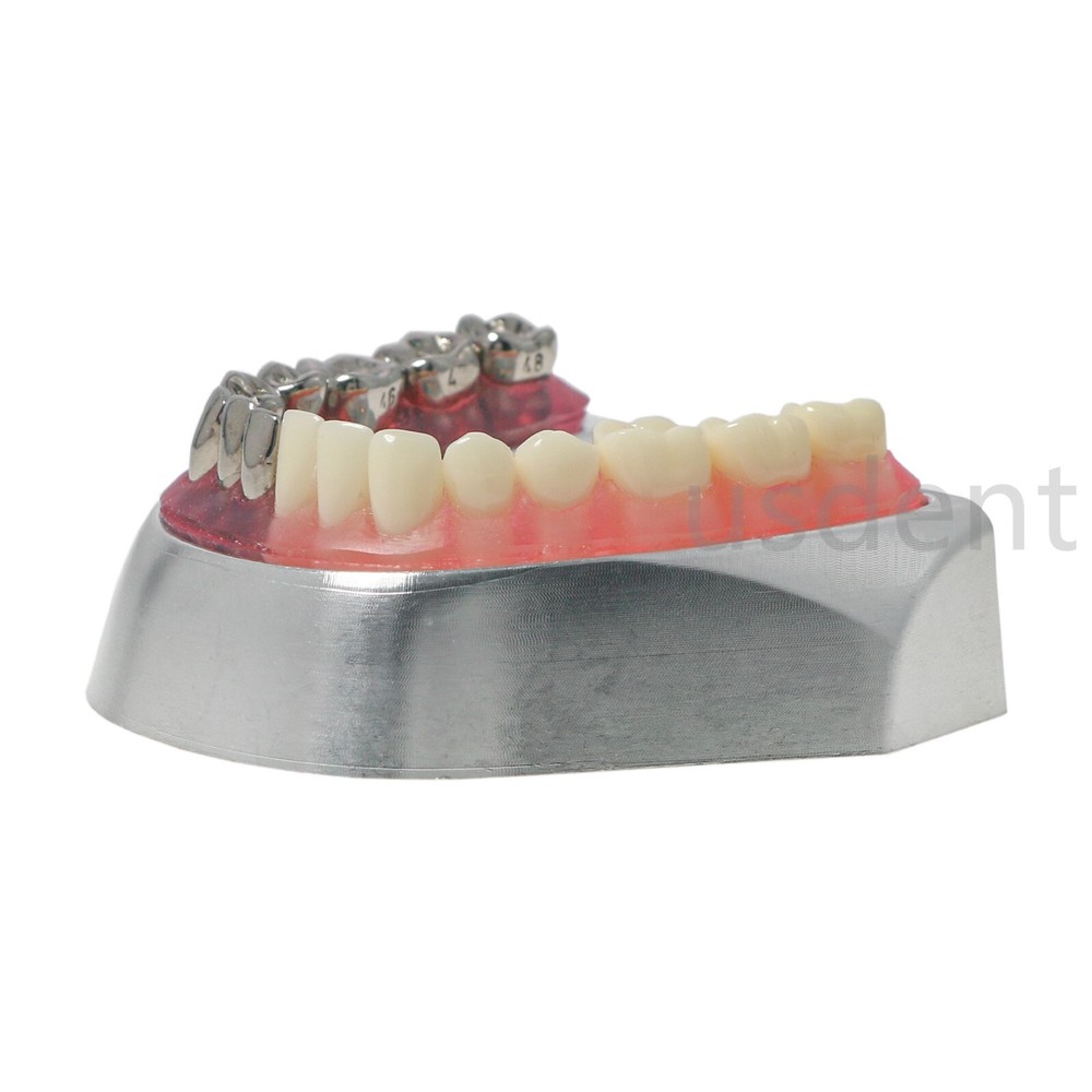 Dental Teeth Model With Restoration Learning and Teaching Demonstrate M6004
