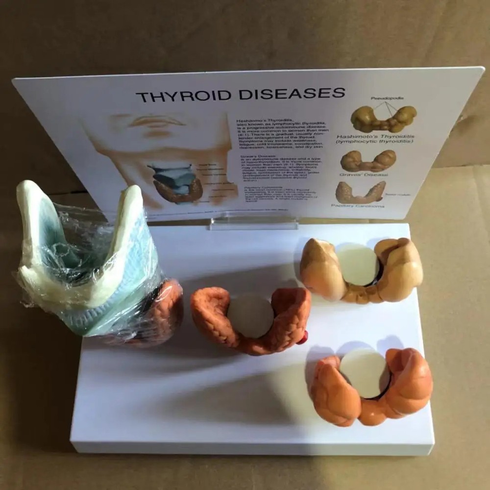 Thyroid Disease Lesion Anatomical Model Thyroid Anatomy Teaching Mode